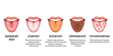 Изменение языка на Языке Мира
