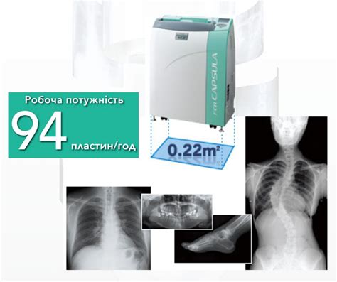 Методы удаления отпечатков пальцев с рентгеновских снимков