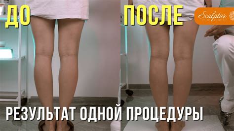 Мифы о возможности увеличить размер ноги