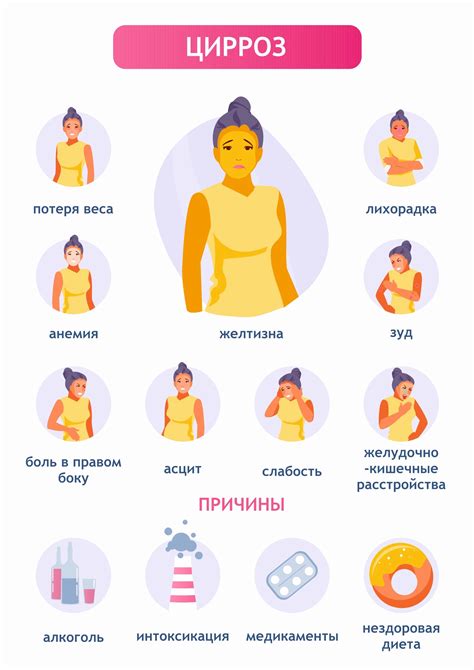 Признаки, что элитры отключены