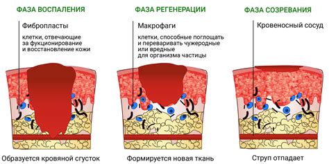 Причины появления ожогов