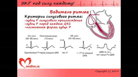 Шаги определения ритма на ЭКГ